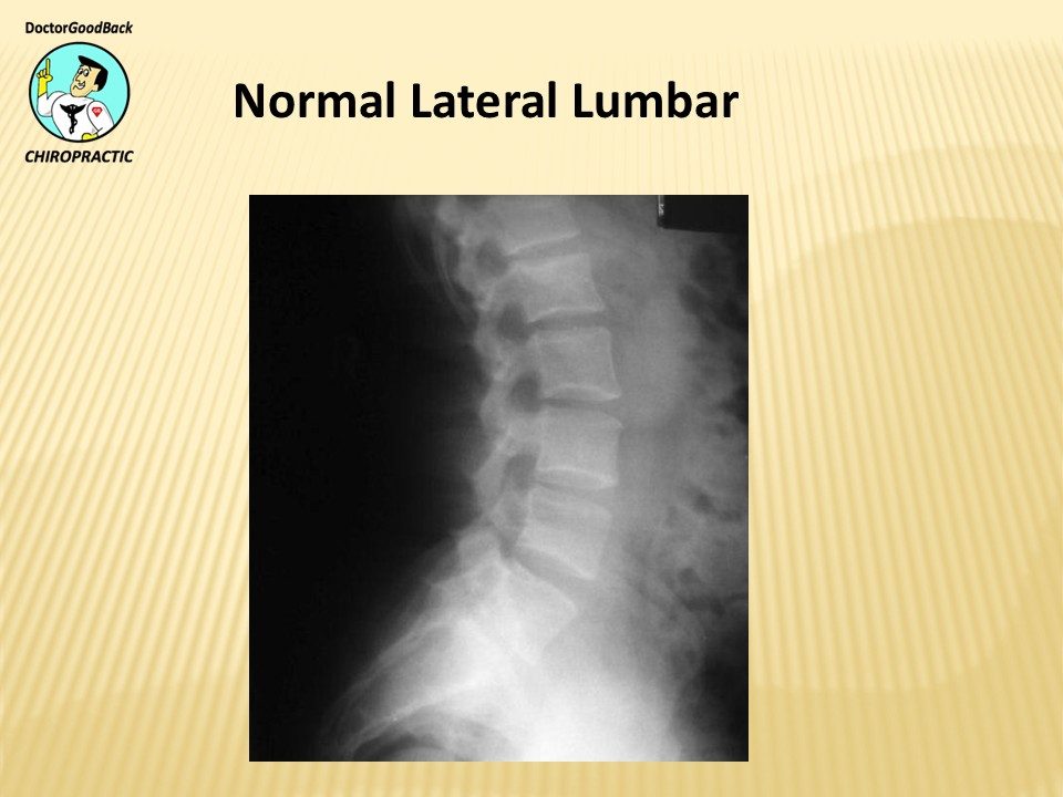 Before and after case 2