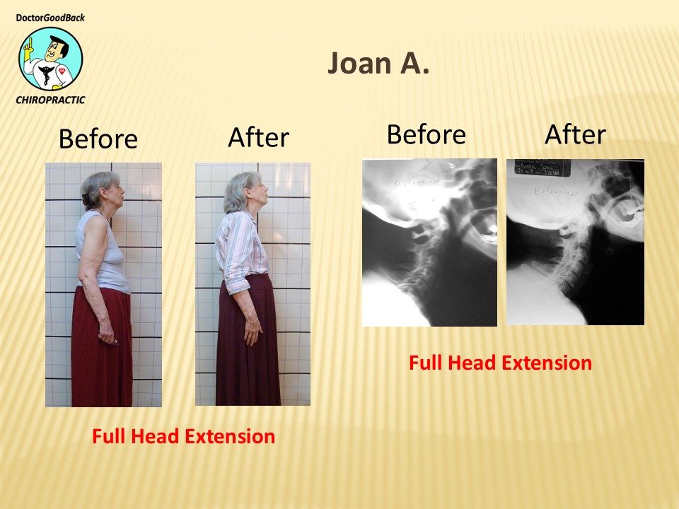 Before and after case 3