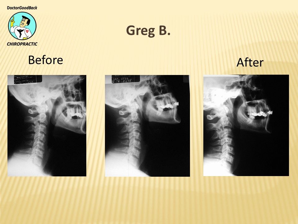 Before and after case 4