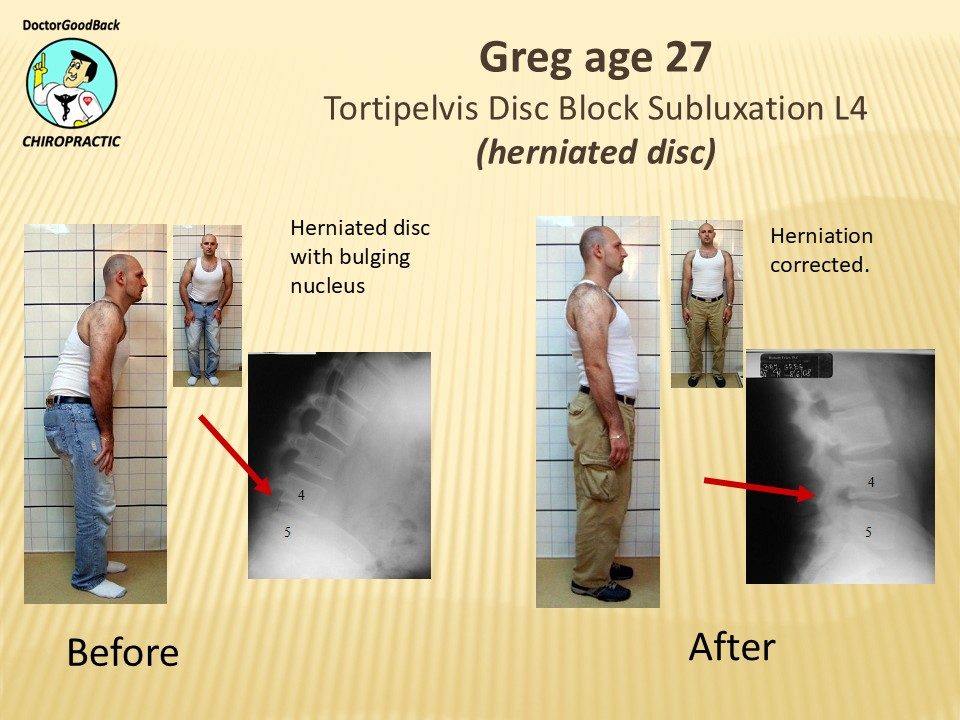 Before and after case 5