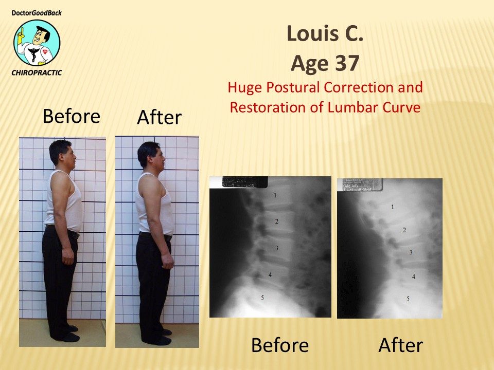 Before and after case 7