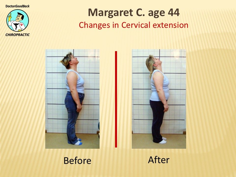 Before and after case 8