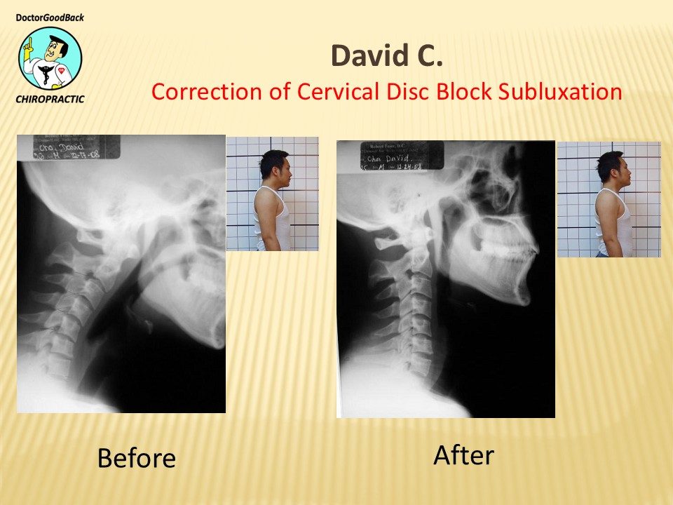 Before and after case 9
