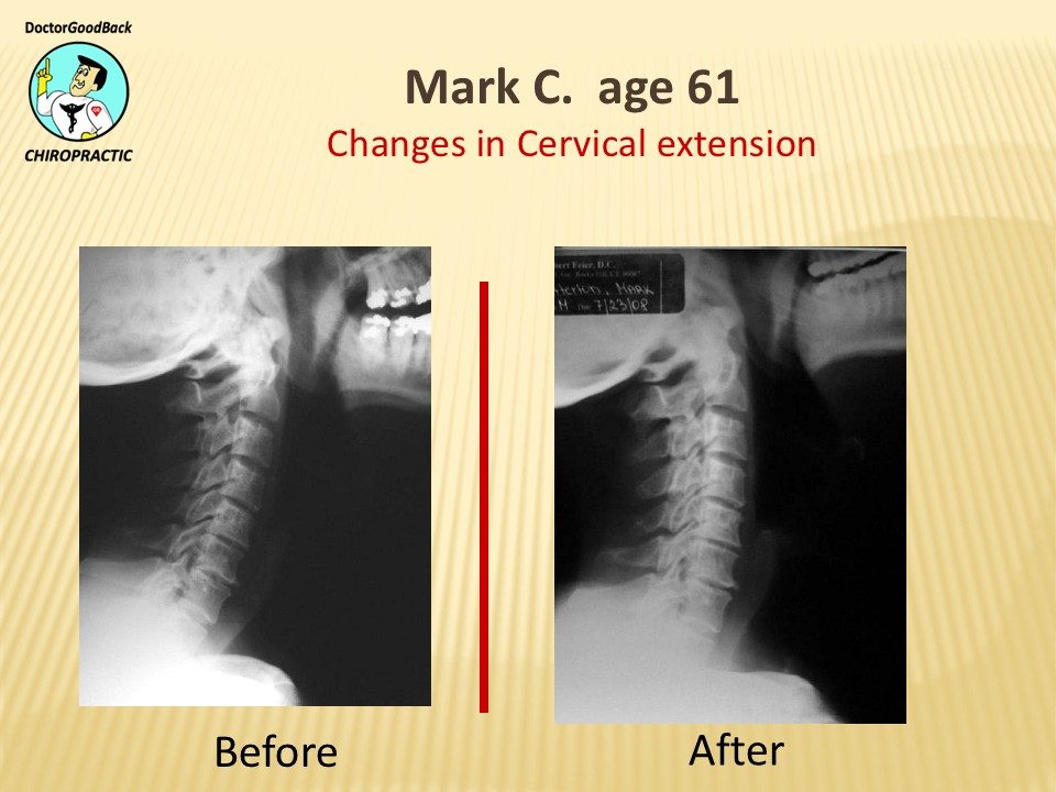 Before and after case 10