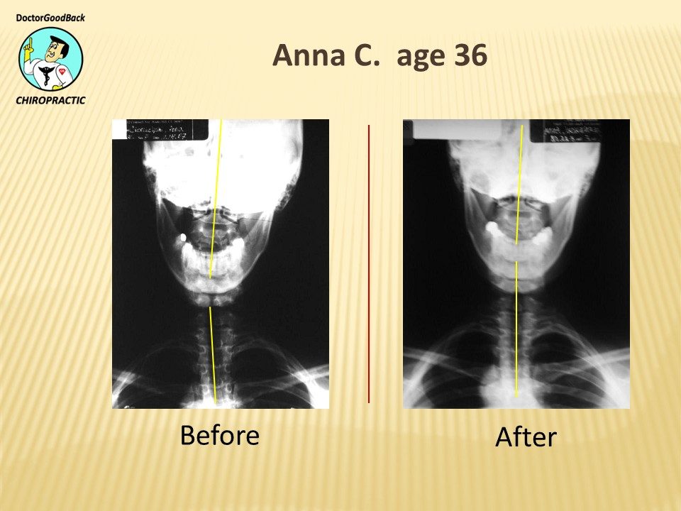 Before and after case 12