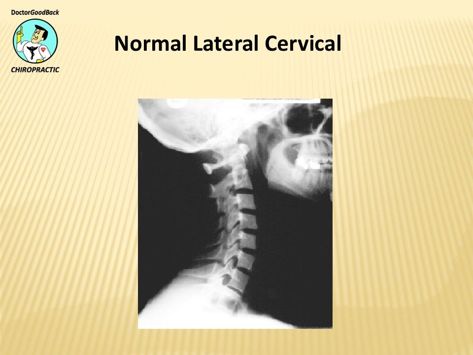 Before and after case 13