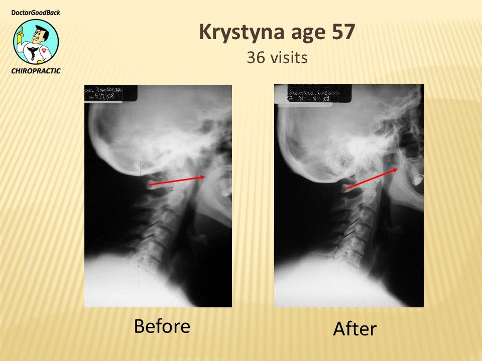 Before and after case 19