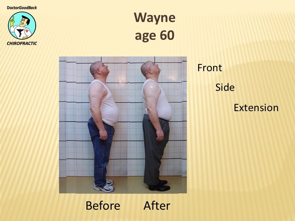 Before and after case 22