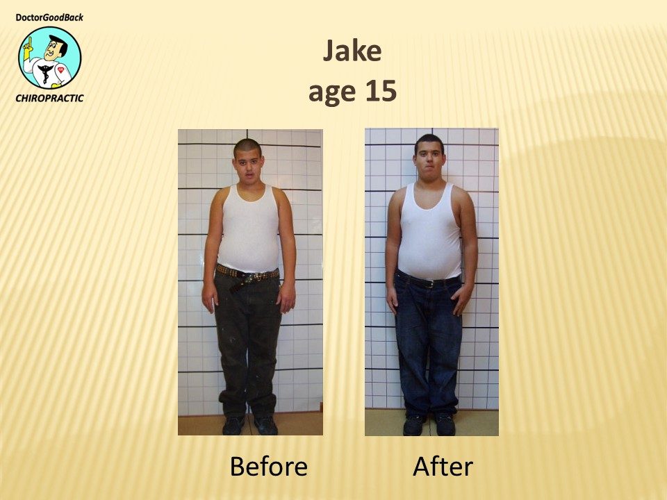 Before and after case 24