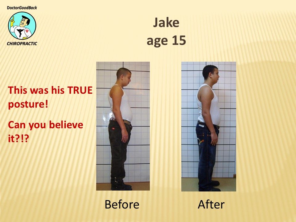 Before and after case 25