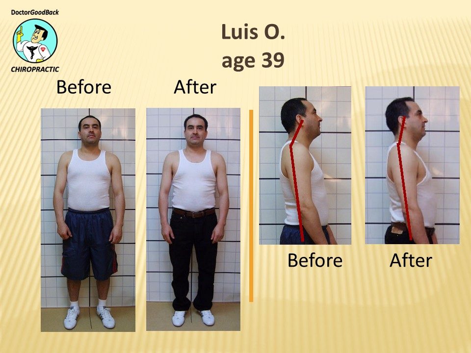 Before and after case 27