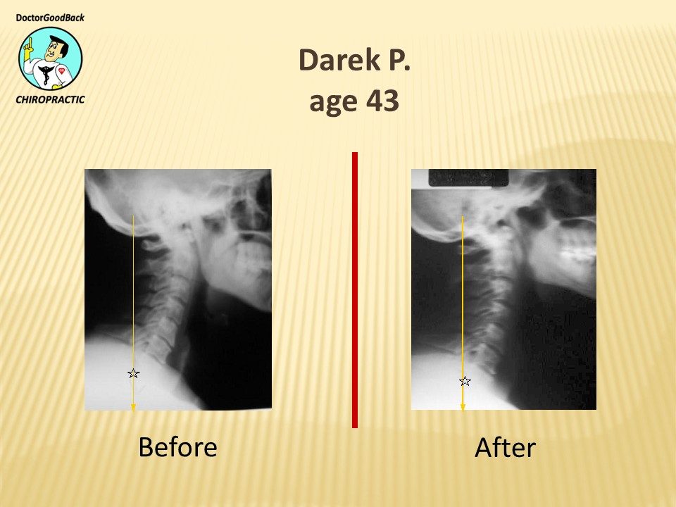 Before and after case 28