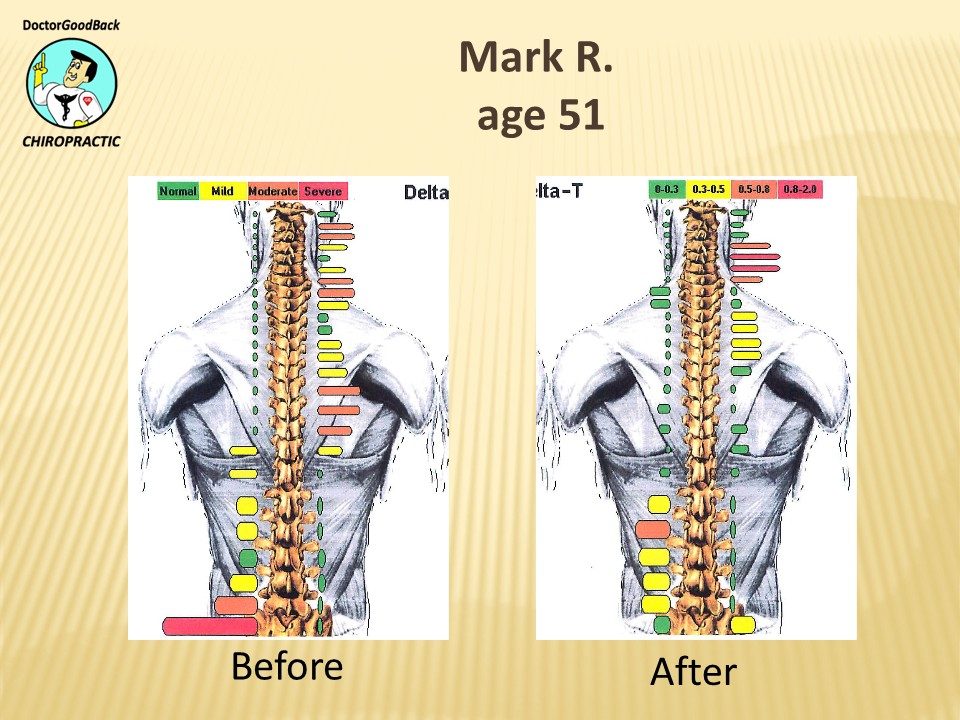 Before and after case 31