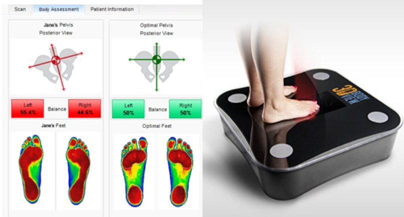 Electronic foot pressure scan