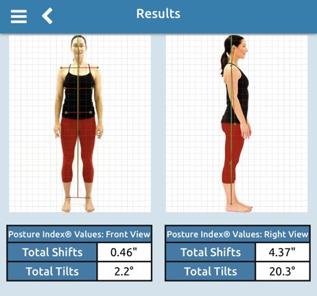 Digital posture analysis results